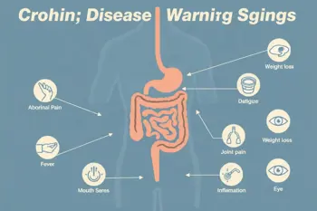 Warning signs of Crohn's disease: A clinical guide to symptoms and evaluation