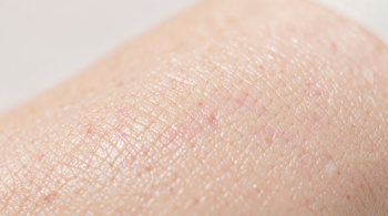 Top natural tips for glowing complexion: A professional overview of skin radiance maintenance