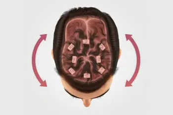 Haarausfall verstehen und behandeln: Bericht, Orientierung und Diagnostik
