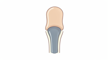 Knee replacement: procedure and costs: A clinical analysis of surgical standards and financial transparency