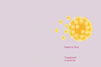 Signs you may have bacterial vaginosis: A clinical overview of symptoms and diagnostic indicators