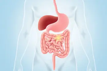 Understand Crohn's disease treatment options: A clinical analysis of management strategies