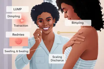 Warning Signs of Breast Cancer: A Clinical Guide to Changes That Merit Evaluation