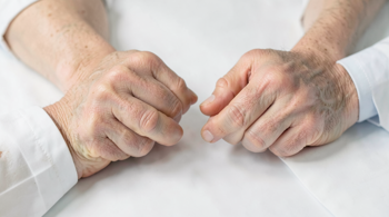 7 segnali d'allarme dell'artrite reumatoide da tenere d'occhio: guida clinica ai sintomi iniziali