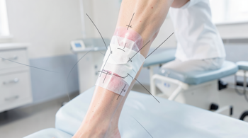 Home recovery for ACL reconstruction: An analytical guide to evidence-based rehabilitation protocols