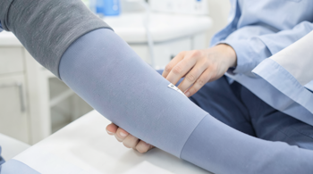 Compression Therapy for Varicose Veins: Effectiveness and Options Analyzed