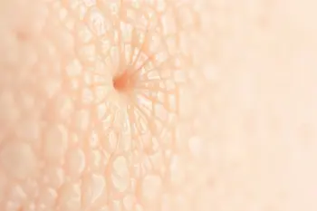 Effective ways to manage eczema discomfort naturally: A Research-Based Clinical Overview
