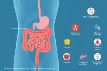 Warning signs of colon cancer: Clinical symptoms and when evaluation matters