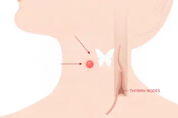 Warning signs of thyroid cancer: A clinical guide to symptoms and evaluation
