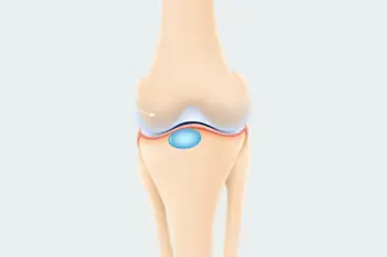 Natural remedies for joint stiffness: A clinical analysis of lifestyle and therapeutic interventions