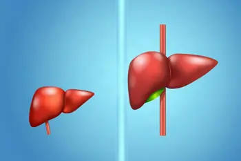 Warning signs of fatty liver disease: A clinical analysis of silent symptoms and metabolic markers