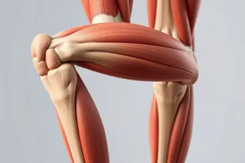 Debolezza alle gambe: cause legate ai muscoli - Analisi clinica e fattori di rischio