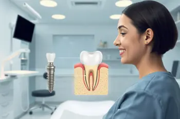 Affordable same-day single dental implants near me: A consumer guide to eligibility, pricing, and risks