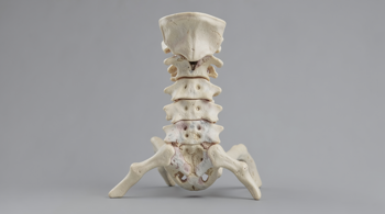 Ursachen für Rückenschmerzen bei Osteoporose: Eine klinische Analyse struktureller und funktioneller Wirbelsäulenveränderungen