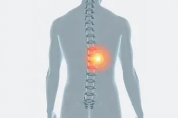 Trattamenti ernia del disco opzioni terapeutiche: un'analisi clinica sugli approcci attuali