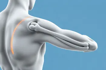 Early symptoms of tendonitis you should know: An Analytical Guide to Identifying Tendon Inflammation