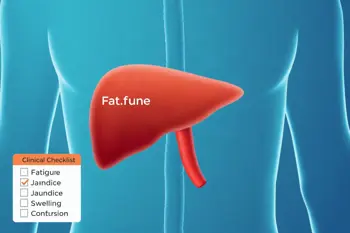 Warning signs of fatty liver disease: Clinical findings, progression, and when evaluation matters