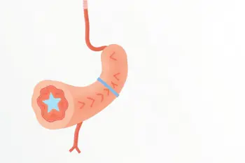 Effective ways to manage occasional heartburn symptoms naturally: A comprehensive clinical overview