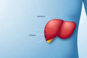 What you need to know about liver cancer symptoms: A clinical guide to warning signs and evaluation