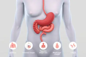 Warning signs of pancreatic cancer: Clinical context and symptom guidance
