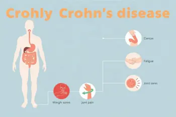 Early symptoms of Crohn's Disease you should know: A Clinical Guide to Recognizing Early Patterns