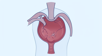 Warning Signs of Bladder Cancer: A Clinical Guide to Symptoms and Evaluation