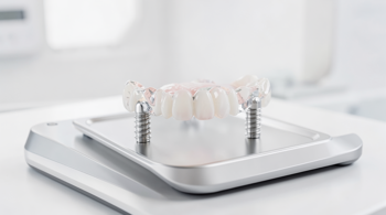 Modern Options for Replacing Missing Teeth in 2026: An Analytical Review of Restorative Clinical Advancements and Patient Considerations