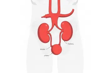 Understanding common kidney stone symptoms: A clinical overview of presentation and progression