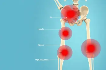 Warning signs of arthritis you should know: A clinical overview of early detection