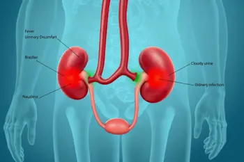Early symptoms of Kidney Infection you should know: A Clinical Guide to Warning Signs