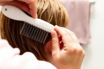 Ways to manage lice eggs at home: A Practical Evidence-Based Guide