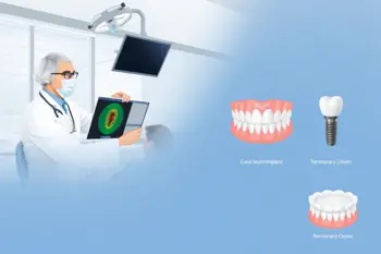Affordable immediate-load dental implants near me: A consumer research briefing