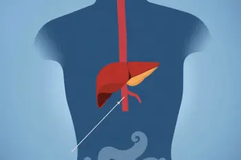 Early Warning Signs of Liver Disease: Clinical Findings and When They Matter