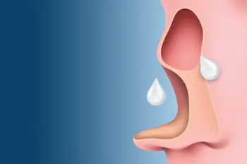 Nasal Polyps Diagnosis and Treatment: A Clinical Review of Diagnostic Protocols and Management Strategies