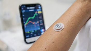 Continuous Glucose Monitors