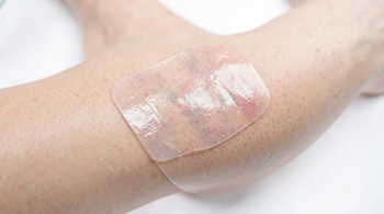 Best silicone scar removal sheets for surgery: Clinical Perspectives on Post-Operative Management