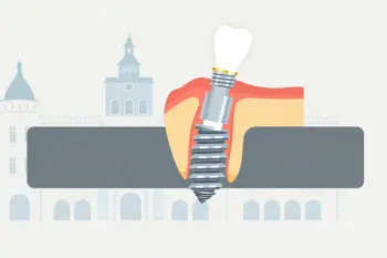 Le meilleur hôpital pour les implants dentaires en France : analyse complète des établissements et critères de choix