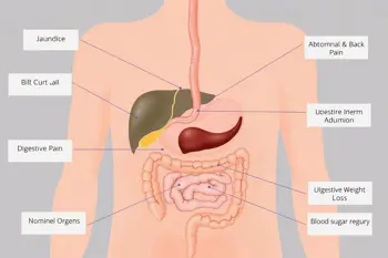 Warning signs of pancreatic cancer: Clinical context and symptoms to recognize