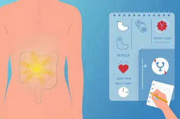 First warning signs of Crohn's disease that you should recognize: A clinical guide to early symptoms