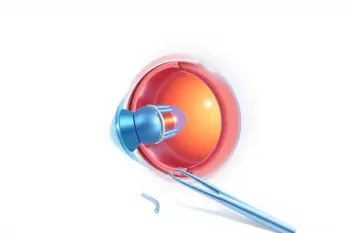 Hospitals Offering Glaucoma Surgery in the United States: A Comprehensive National Guide