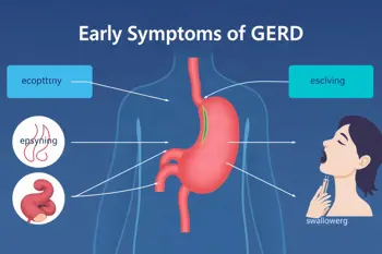 Early symptoms of GERD you should know: A clinical guide to recognizing reflux