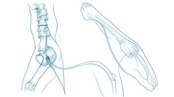 Warning signs of herniated disc: A clinical guide to symptoms and urgency