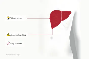 Warning signs of liver disease to watch for: A clinical guide to symptoms and next steps