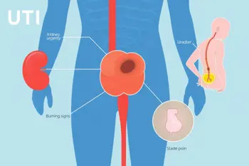 Warning signs of a urinary tract infection: A clinical guide to symptoms and severity