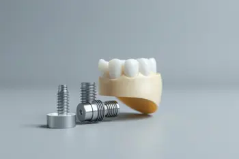 NHS Coverage for Single Tooth Implants in 2026: What UK Patients Need to Know