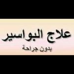 علاج البواسير