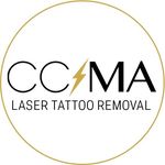 TATTOO REMOVAL