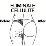 Eliminate Cellulite 🍊🙅