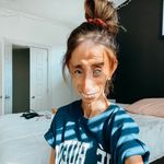 Lizzie Velasquez