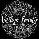 Vitiligo Beauty